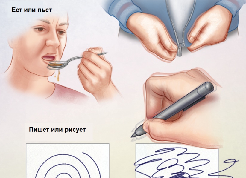 Почему трясутся руки и что с этим делать